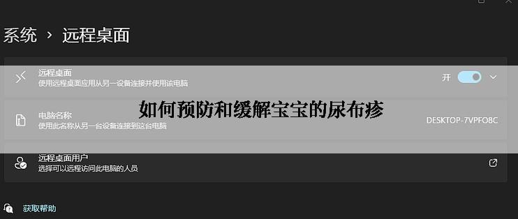  如何预防和缓解宝宝的尿布疹