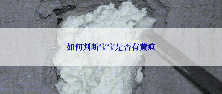 如何判断宝宝是否有黄疸