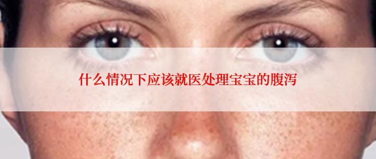 什么情况下应该就医处理宝宝的腹泻