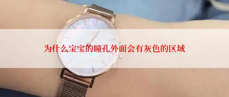 为什么宝宝的瞳孔外面会有灰色的区域