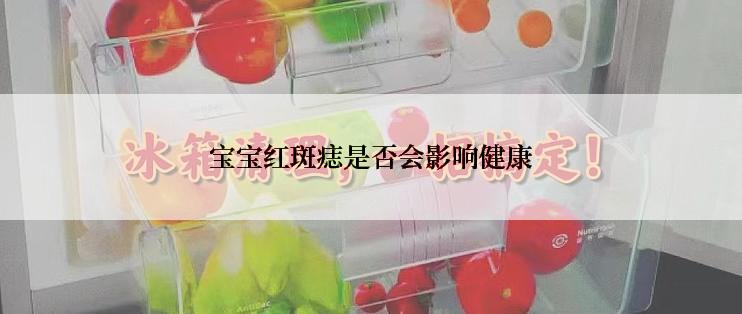 宝宝红斑痣是否会影响健康